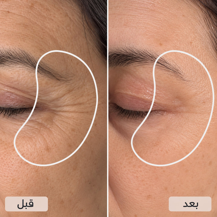 ملمس أكثر نعومة